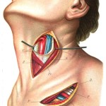 Neck Dissection